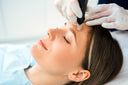 Micro-Needling für Gesicht, Hals & Dekolleté