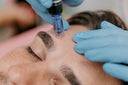 Micro-Needling für Gesicht & Hals